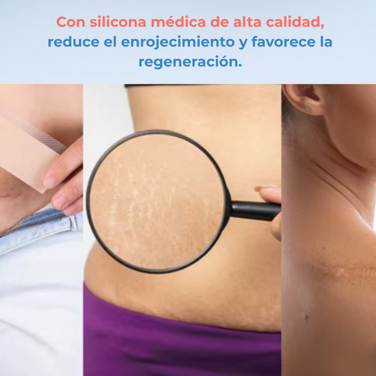 BodyEase™ – Faja postparto de soporte abdominal