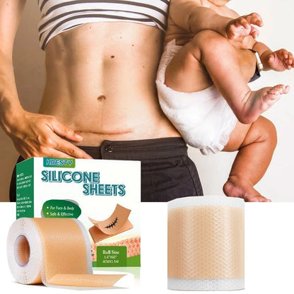 BodyEase™ – Faja postparto de soporte abdominal